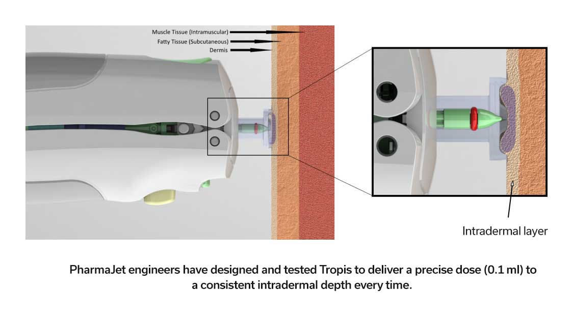 Tropis® ID jet injector needle-free system delivers a precise dose (0.1 ml) to a consistent intradermal depth every time