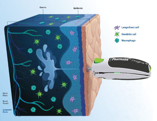 Tropis offers all the enhanced immune response benefits of skin delivery while eliminating the challenges of Mantoux