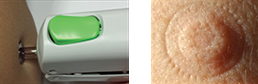 tropis-in-use